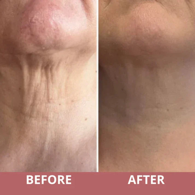 NeckLuxe™ Boost Circulation Naturally
