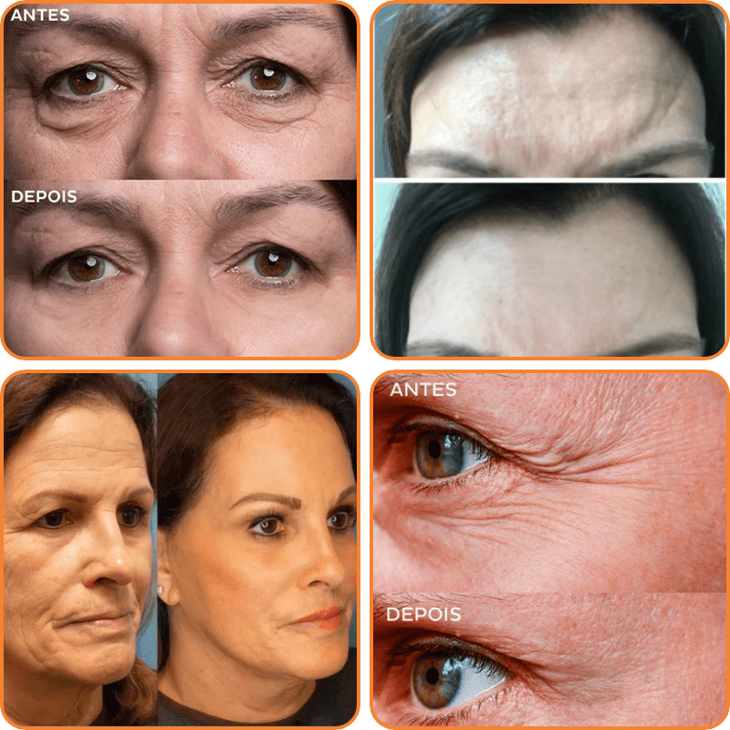 1+1 Free | HydraGlow™ Wrinkle-Fading Hydration Boost