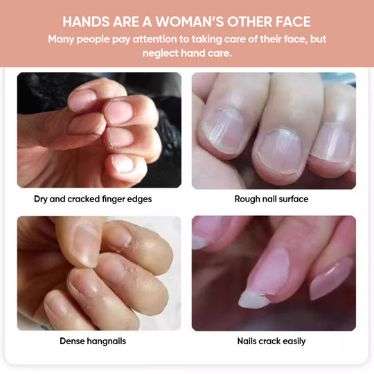 NailElixir™ Strengthen Your Nails