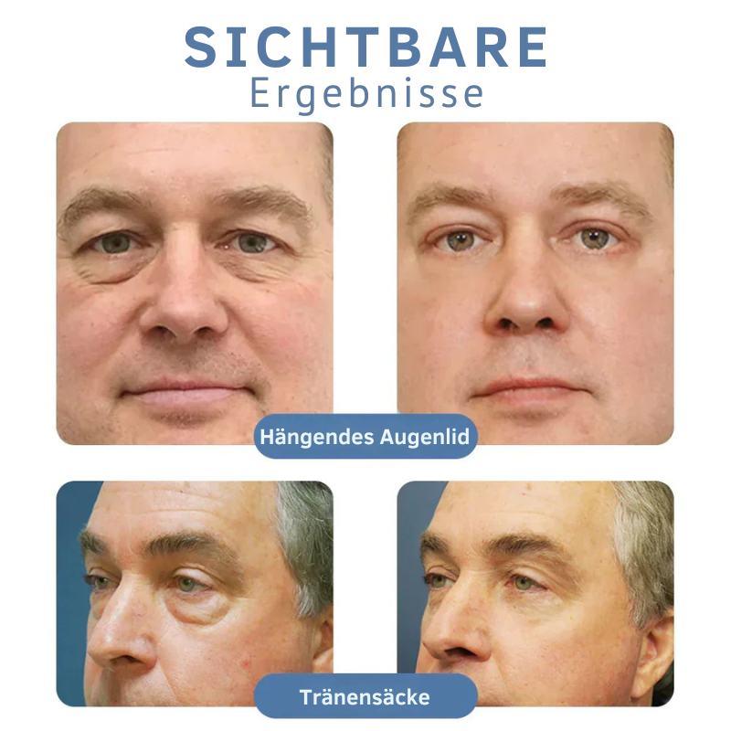 PeptiGlow™ Firms Eye Area