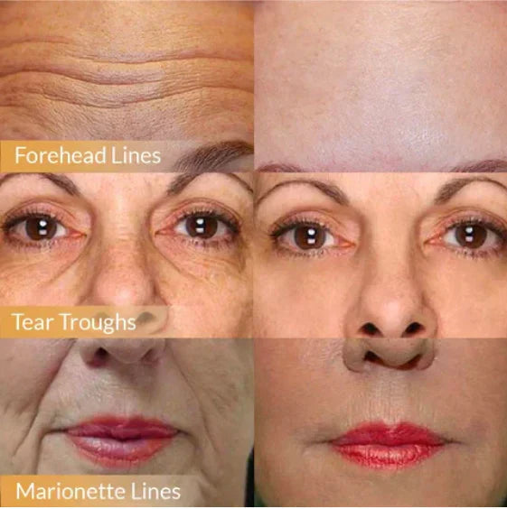 FaceLuxe™ Ageless Confidence Cream
