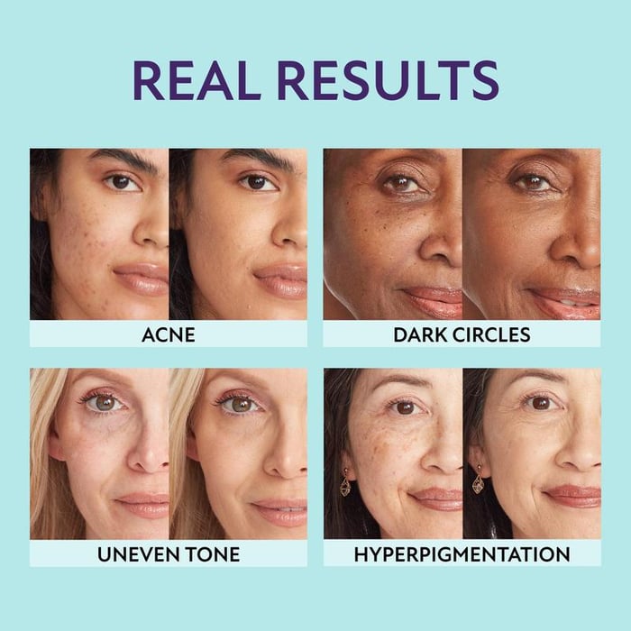DewBlend™ Hide Blemishes Instantly