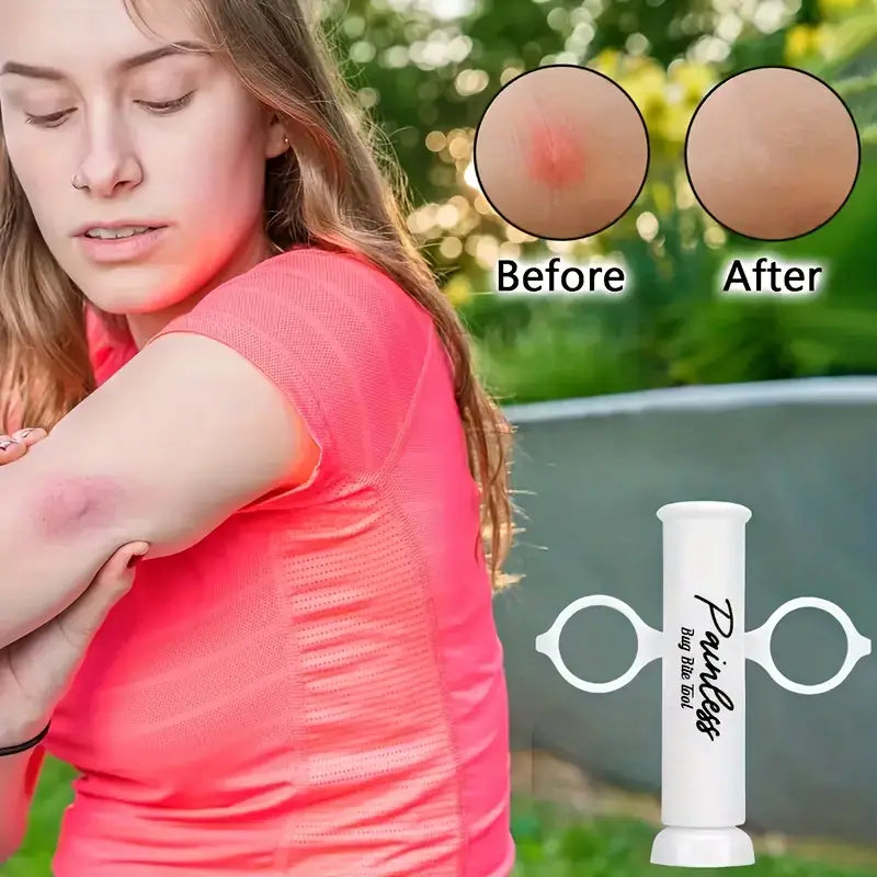 2+2 Free | BiteAway™ Instant Itch Relief