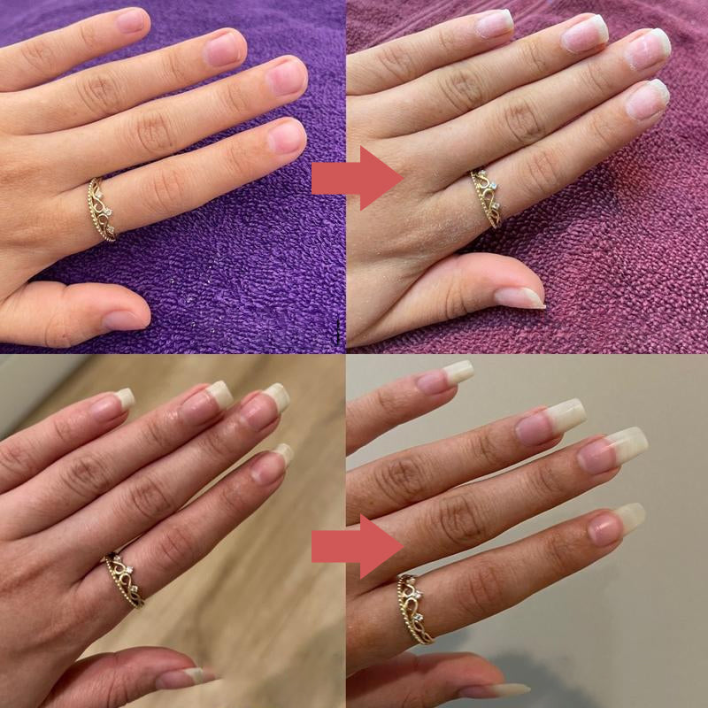 NailElixir™ Strengthen Your Nails