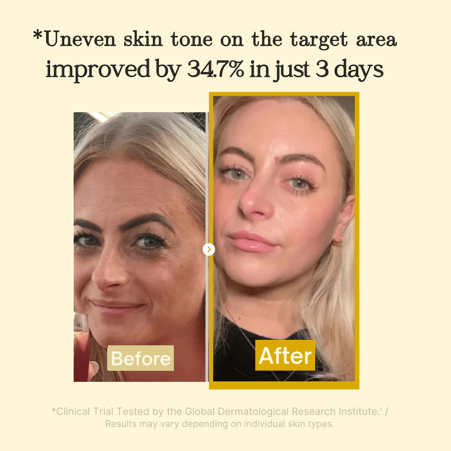 2+2 Free | LumeSkin™ Clear Bright Complexion