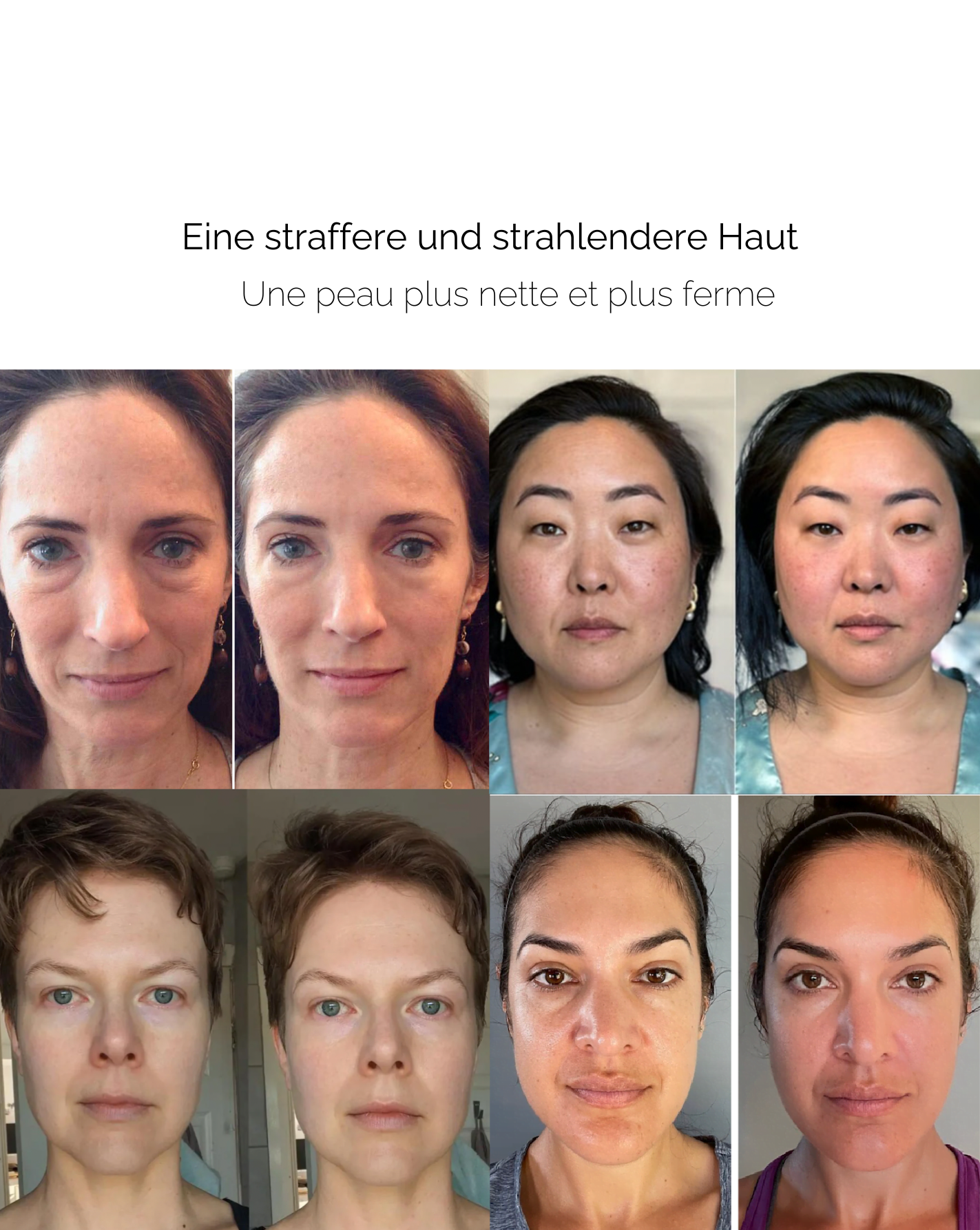 VitalRoller™ Ageless Beauty Glow