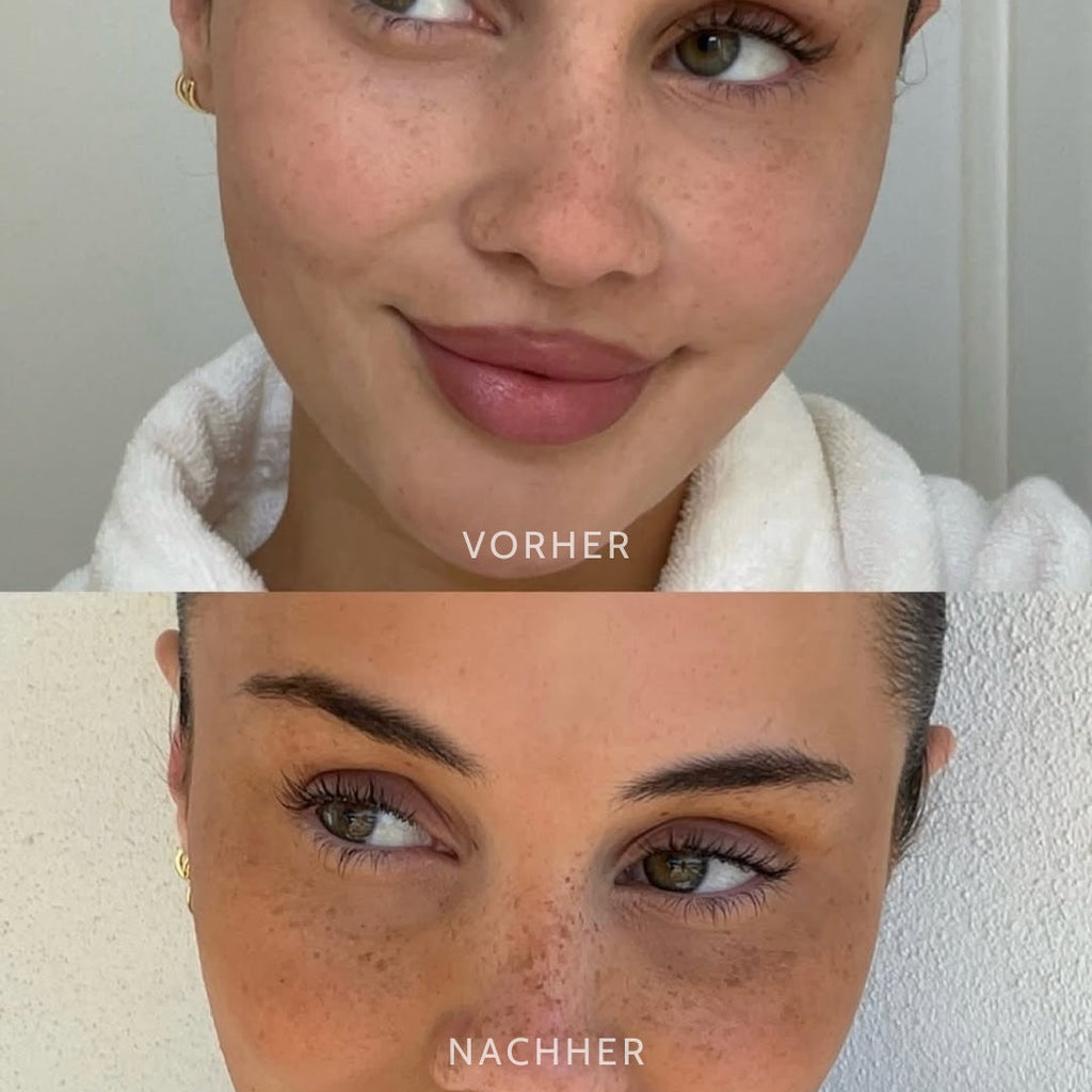 SpeckleTouch™ Playful Beauty Accent
