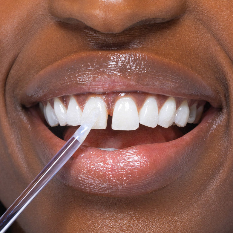 ShineSmile™ Instant Bright Smile Boost