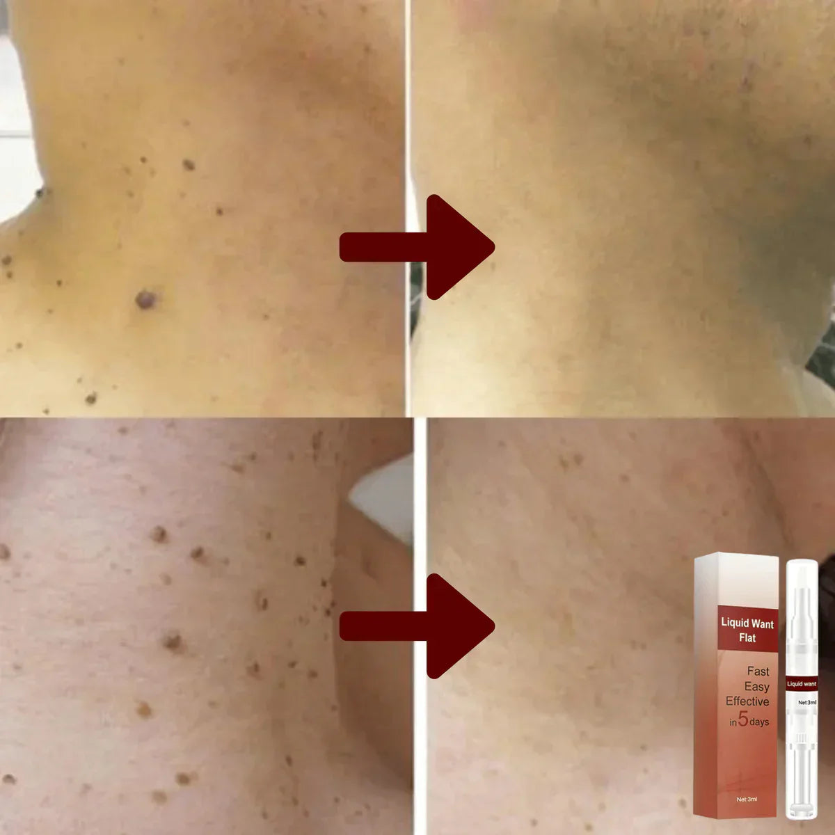 1+1 Free | SpotEraser™ Painless Spot Removal