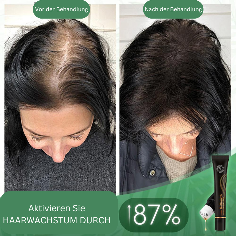 1+1 Free | GrowthRoller™ Stimulates Hair Growth