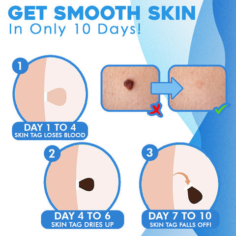 SmoothFix™ Restore Clear Skin
