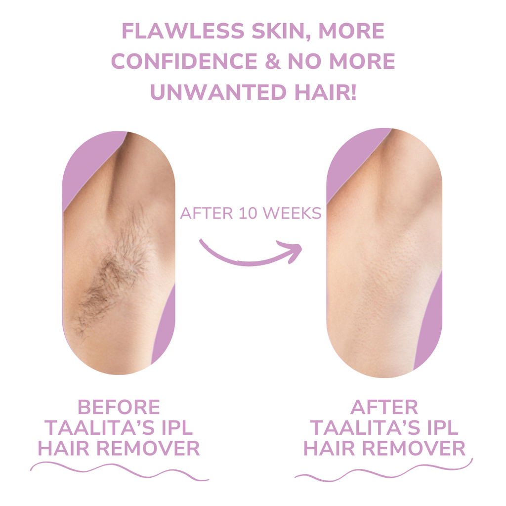 SmoothTouch™ Smooth Skin Fast