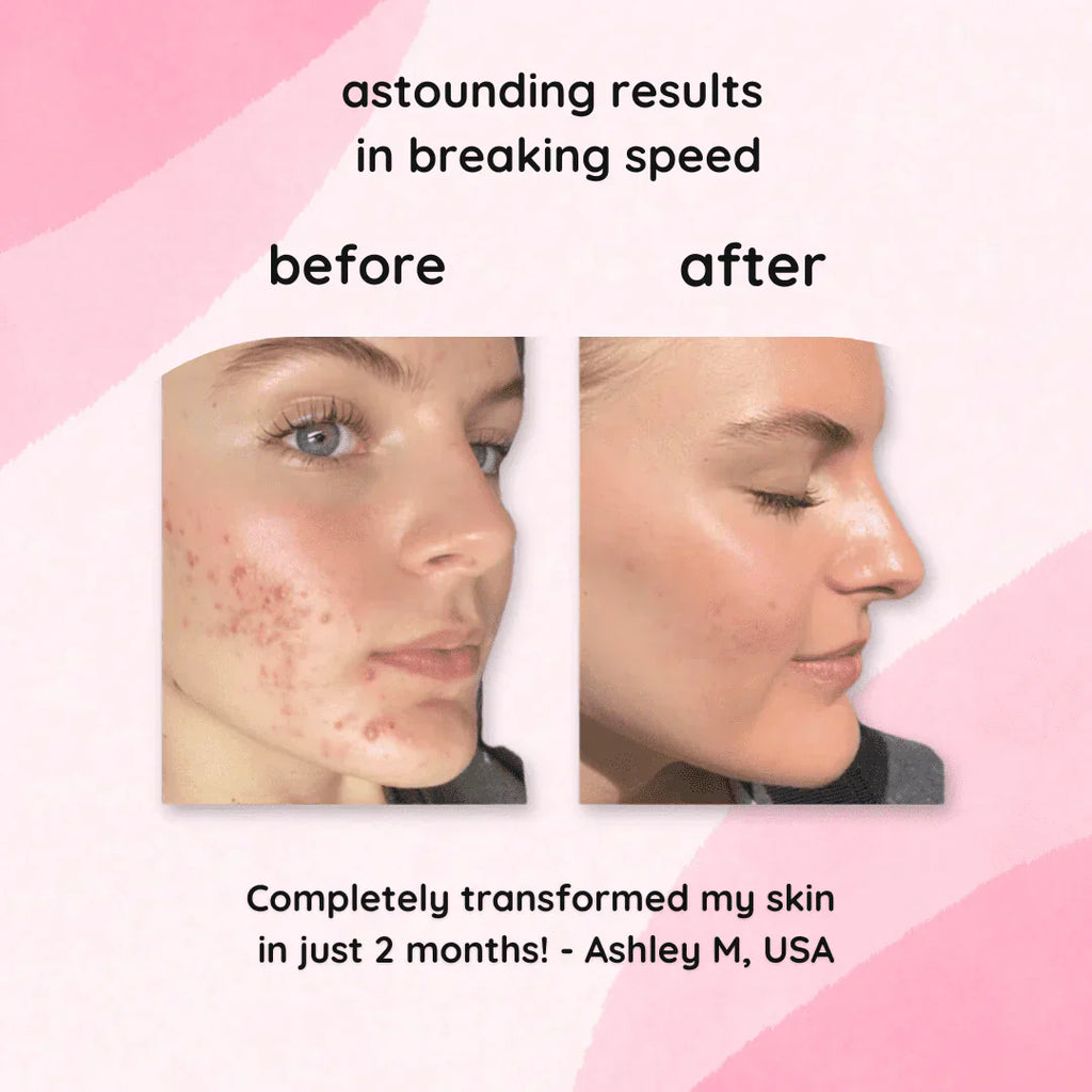 2+2 Free | BrightEase™ Gentle Bright Glow