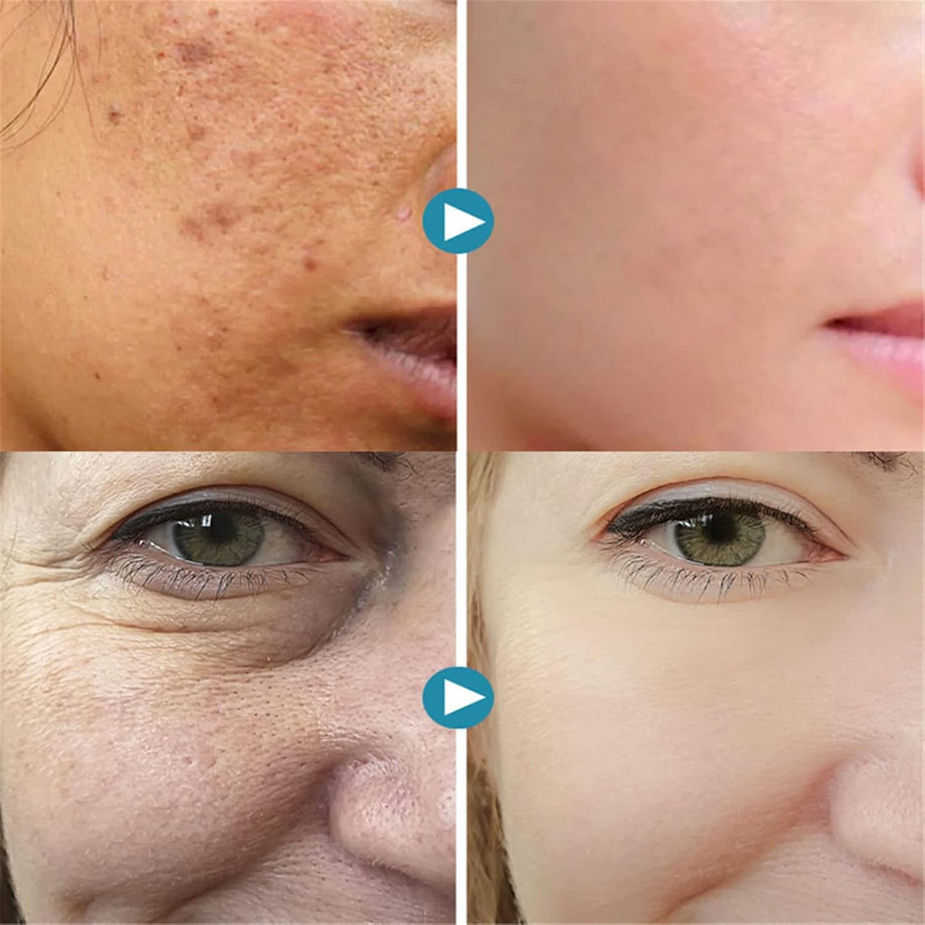 1+1 Free | PorePerfect™ Blur Imperfections Instantly