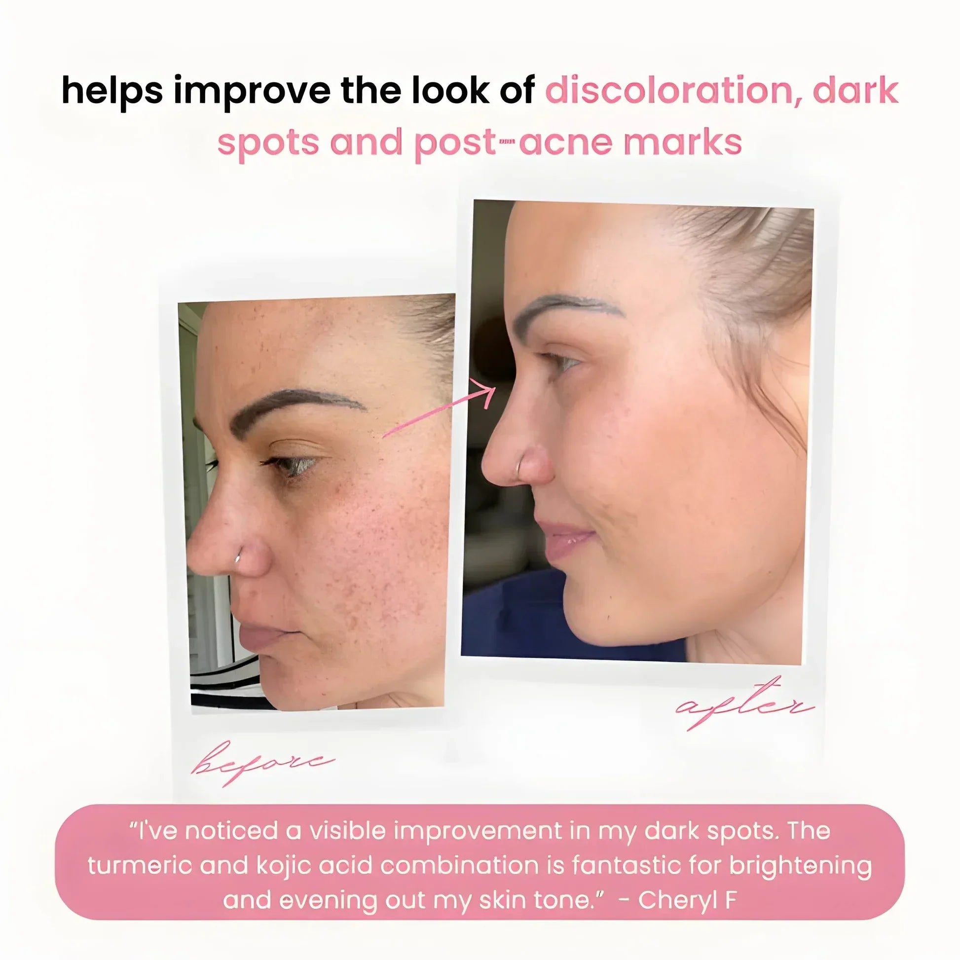 2+2 Free | BrightEase™ Gentle Bright Glow